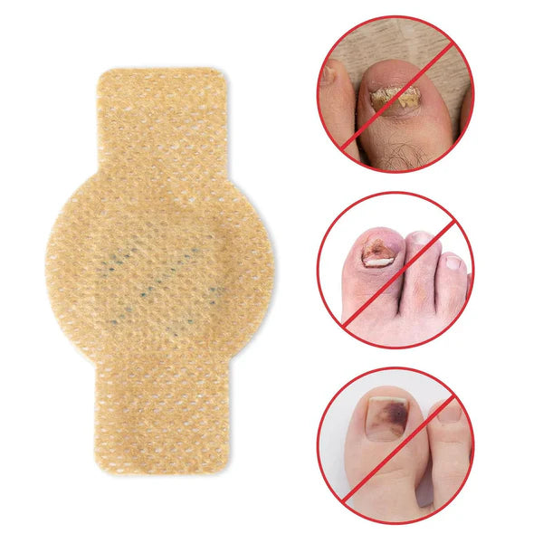 Fungal Nail Patches 🌿💅 ( Buy 1 Get 1 Free🔥🔥)