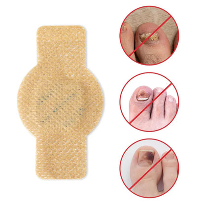 Fungal Nail Patches 🌿💅 ( Buy 1 Get 1 Free🔥🔥)