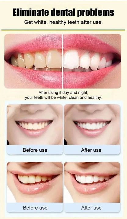 Ultra Probiotic Whitening Toothpaste ( Buy 1 Get 1 Free) 🔥